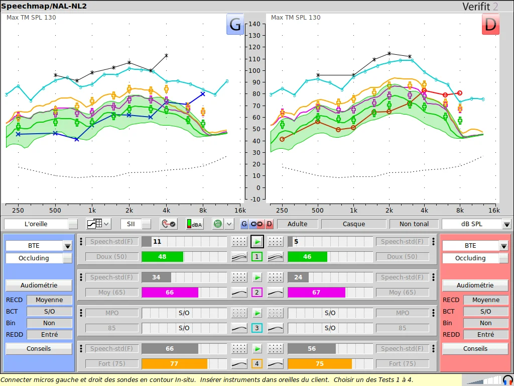 Exemple de mesure in vivo sur Verifit 2 (Speechmap/NAL-NL2) : courbes REAR oreilles gauche et droite, cibles et niveaux doux, moyen et fort